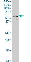 Anti-STK33 Mouse Monoclonal Antibody [clone: 4F7]