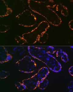 Immunofluorescence analysis of human placenta using Anti-Placental lactogen Antibody [ARC2426] (A306956) at a dilution of 1:100 (40x lens). DAPI was used to stain the cell nuclei (blue).