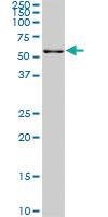 Anti-FGR Mouse Monoclonal Antibody [clone: 3B11]