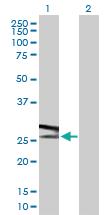 Anti-ATP6V1E1 Rabbit Polyclonal Antibody