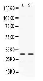 Anti-CA3 Rabbit Polyclonal Antibody