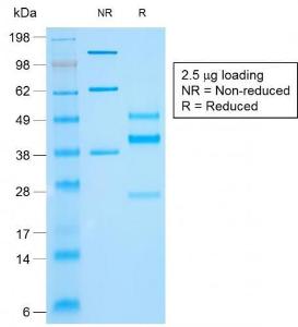 SDS-PAGE analysis of Anti-Cytokeratin 10 Antibody [rKRT10/844] under non-reduced and reduced conditions; showing intact IgG and intact heavy and light chains, respectively. SDS-PAGE analysis confirms the integrity and purity of the antibody.