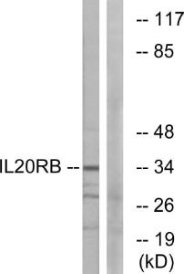 Western blot analysis of lysates from HeLa cells using Anti-IL20RB Antibody. The right hand lane represents a negative control, where the antibody is blocked by the immunising peptide