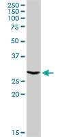 Anti-ATP6V1E1 Rabbit Polyclonal Antibody