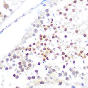 Immunohistochemistry analysis of paraffin-embedded rat testis using Anti-NUP50 Antibody (A12363) at a dilution of 1:100 (40x lens). Perform microwave antigen retrieval with 10 mM Tris/EDTA buffer pH 9.0 before commencing with IHC staining protocol.