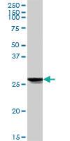 Anti-ATP6V1E1 Rabbit Polyclonal Antibody