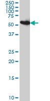 Anti-PDIA5 Mouse Monoclonal Antibody [clone: 3A3]