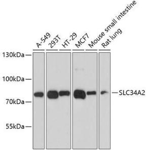 Western blot analysis of extracts of various cell lines, using Anti-SLC34A2 Antibody (A12364) at 1:3,000 dilution. The secondary antibody was Goat Anti-Rabbit IgG H&L Antibody (HRP) at 1:10,000 dilution.