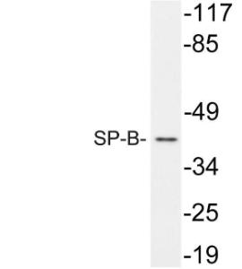 Western blot analysis of lysate from A549 cells using Anti-SP-B Antibody