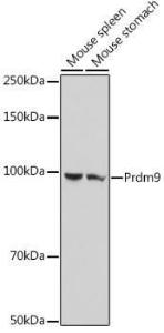 Western blot analysis of extracts of various cell lines, using Anti-Prdm9 Antibody (A305644) at 1:1,000 dilution. The secondary antibody was Goat Anti-Rabbit IgG H&L Antibody (HRP) at 1:10,000 dilution.