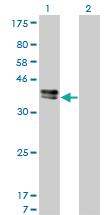 Anti-ISL1 Mouse Monoclonal Antibody [clone: 1A3]