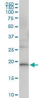 Anti-DUSP22 Polyclonal Antibody Pair