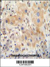 Anti-NR0B2 Rabbit Polyclonal Antibody (HRP (Horseradish Peroxidase))