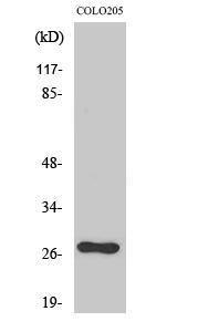 Western blot analysis of various cells using Anti-OTUB2 Antibody