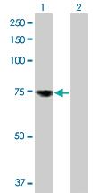 Anti-MSLN Rabbit Polyclonal Antibody