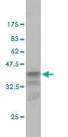 Anti-CCT7 Mouse Monoclonal Antibody [clone: 1D6]