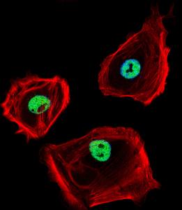 Anti-CTBP1 Rabbit Polyclonal Antibody (FITC (Fluorescein Isothiocyanate))