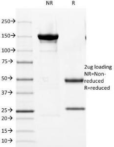 SDS-PAGE analysis of Anti-Cytokeratin 8 Antibody [KRT8/803] under non-reduced and reduced conditions; showing intact IgG and intact heavy and light chains, respectively. SDS-PAGE analysis confirms the integrity and purity of the Antibody