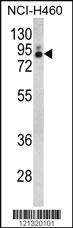 Anti-PLA2G4A Rabbit Polyclonal Antibody