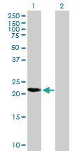 Anti-CDKN1B Mouse Polyclonal Antibody