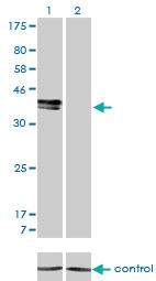 Anti-ISL1 Mouse Monoclonal Antibody [clone: 1A3]