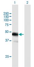 Anti-FBLIM1 Mouse Polyclonal Antibody