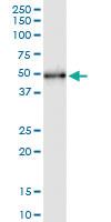 Anti-UIMC1 Polyclonal Antibody Pair