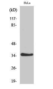 Western blot analysis of various cells using Anti-IL20RB Antibody