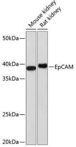 Western blot analysis of extracts of various cell lines, using Anti-EpCAM Antibody [ARC0521] (A306962) at 1:1000 dilution. The secondary Antibody was Goat Anti-Rabbit IgG H&L Antibody (HRP) at 1:10000 dilution. Lysates/proteins were present at 25 µg per lane