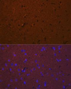 Immunofluorescence analysis of rat brain using Anti-DCAMKL1 Antibody (A12365) at a dilution of 1:100 (40X lens). DAPI was used to stain the cell nuclei (blue)