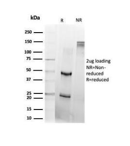 SDS-PAGE analysis of Anti-DAXX Antibody [PCRP-DAXX-8C2] under non-reduced and reduced conditions; showing intact IgG and intact heavy and light chains, respectively. SDS-PAGE analysis confirms the integrity and purity of the antibody.