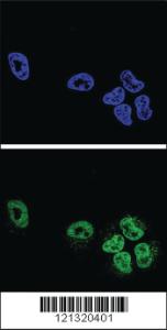 Anti-PLA2G4A Rabbit Polyclonal Antibody