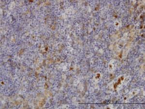 Anti-FGR Mouse Monoclonal Antibody [clone: 3B11]