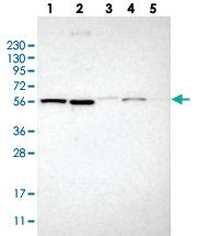 Anti-TMEM194A Rabbit Polyclonal Antibody