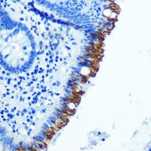 Immunohistochemistry analysis of paraffin-embedded human appendix tissue using Anti-EpCAM Antibody [ARC0521] (A306962) at a dilution of 1:100 (40X lens). Perform microwave antigen retrieval with 10 mM PBS buffer pH 7.2 before commencing with IHC staining protocol