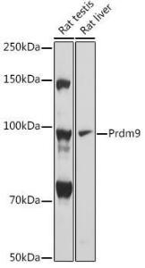 Western blot analysis of extracts of various cell lines, using Anti-Prdm9 Antibody (A305644) at 1:1,000 dilution. The secondary antibody was Goat Anti-Rabbit IgG H&L Antibody (HRP) at 1:10,000 dilution.