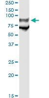 Anti-GP1BA Antibody Pair