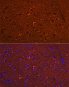 Immunofluorescence analysis of mouse brain using Anti-DCAMKL1 Antibody (A12365) at a dilution of 1:100 (40X lens). DAPI was used to stain the cell nuclei (blue)