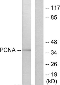 Western blot analysis of lysates from HepG2 cells using Anti-PCNA Antibody. The right hand lane represents a negative control, where the antibody is blocked by the immunising peptide