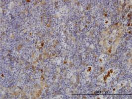 Anti-FGR Mouse Monoclonal Antibody [clone: 3B11]