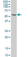 Anti-STK33 Mouse Monoclonal Antibody [clone: 3F10]