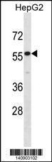 Anti-IL17RE Rabbit Polyclonal Antibody (AP (Alkaline Phosphatase))