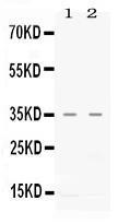 Anti-CXCL16 Rabbit Polyclonal Antibody