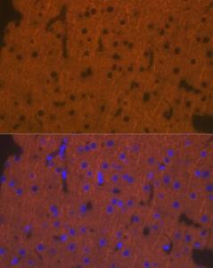 Immunofluorescence analysis of rat brain cells using Anti-DCAMKL1 Antibody (A12365) at a dilution of 1:100 (40X lens). DAPI was used to stain the cell nuclei (blue)