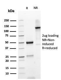 SDS-PAGE analysis of Anti-gamma Parvin Antibody [PARVG/6312R] under non-reduced and reduced conditions; showing intact IgG and intact heavy and light chains, respectively SDS-PAGE analysis confirms the integrity and purity of the antibody