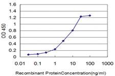 Anti-FGR Mouse Monoclonal Antibody [clone: 3B11]