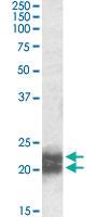 Anti-NPC2 Goat Polyclonal Antibody