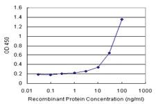 Anti-CDK20 Antibody Pair