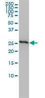 Anti-PHB Mouse Monoclonal Antibody [clone: 3F4-2B2]