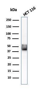 Western blot analysis of HCT116 cell lysate using Anti-Cytokeratin 8 Antibody [KRT8/803]